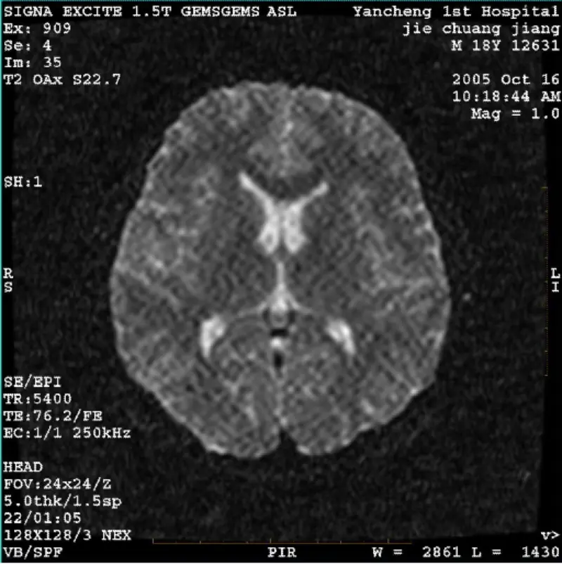 ARTIFACT WI/Fiesta Изображение Белый Пиксель