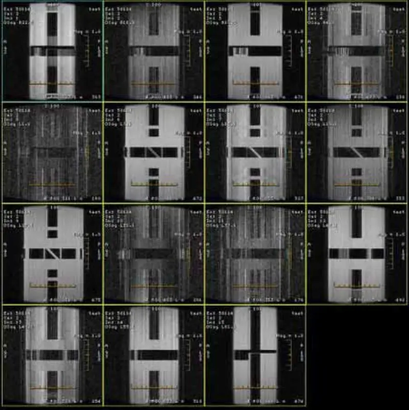 Артефакт FSE и GRE